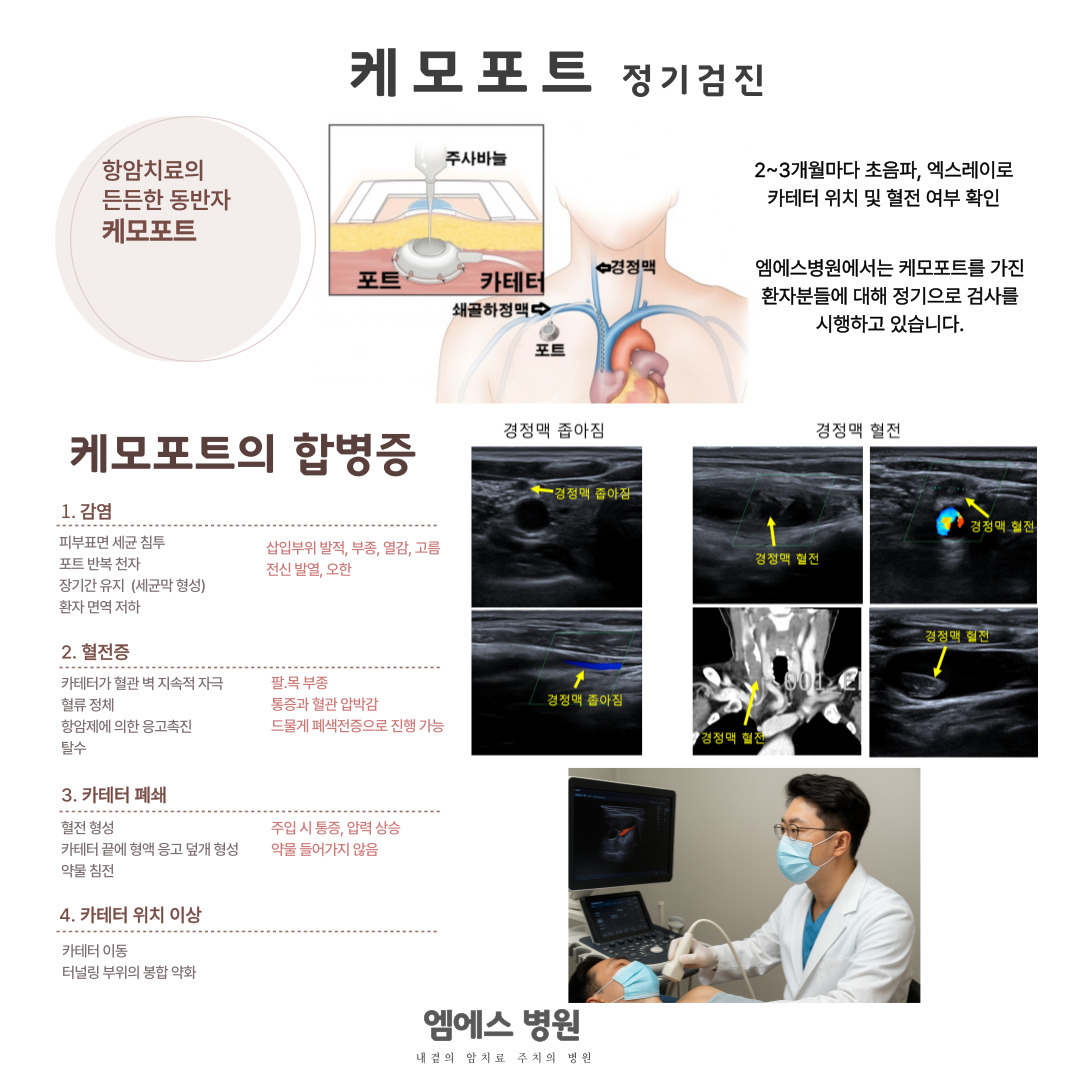 케모포트 정기검사