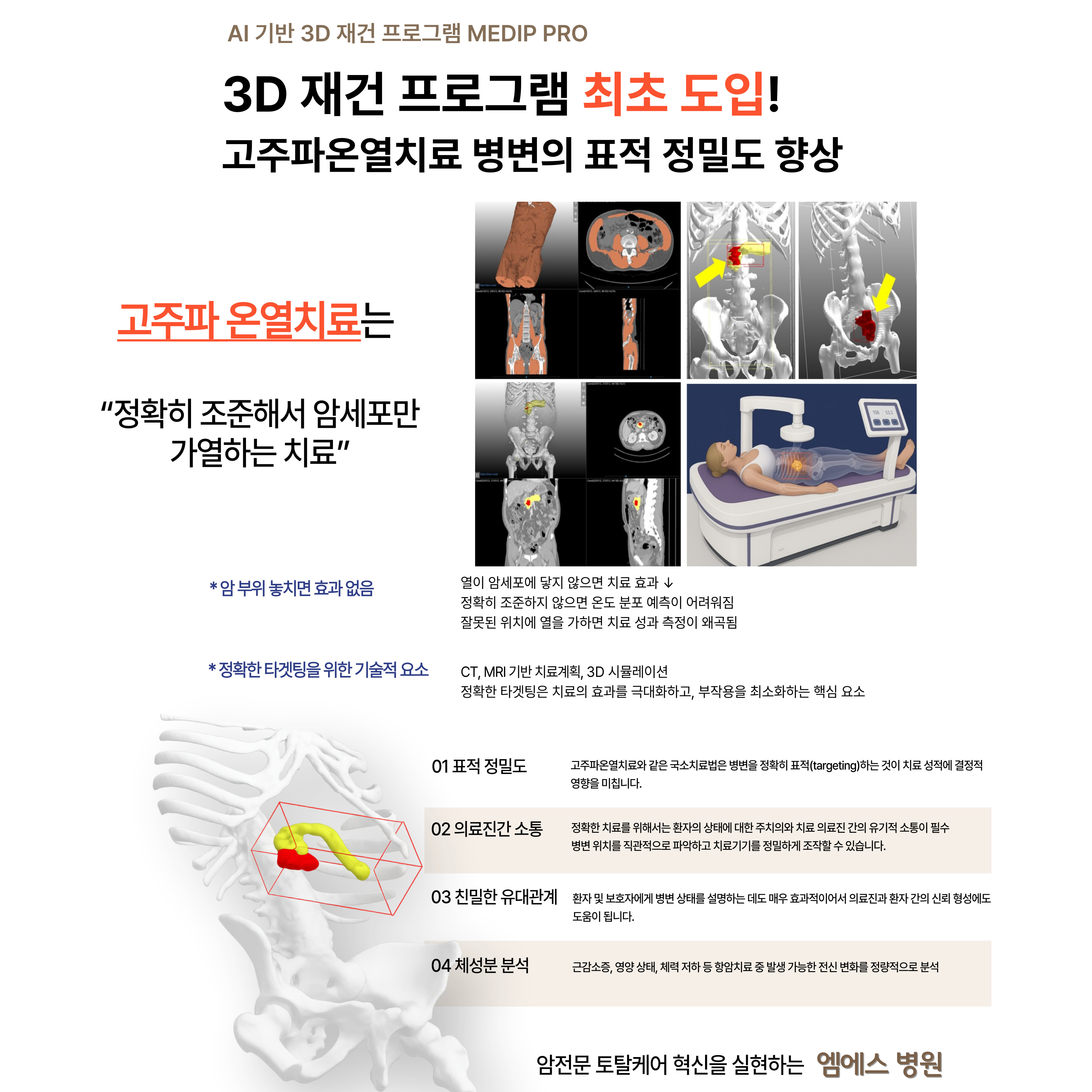 고주파온열치료 정밀도 향상